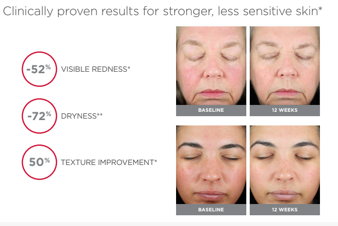 ELTA UV Skin Recovery SPF 50