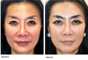 INVO Rejuvenating Complex